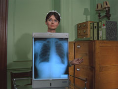 Matron stands behind an x-ray viewer, showing a chest x-ray
